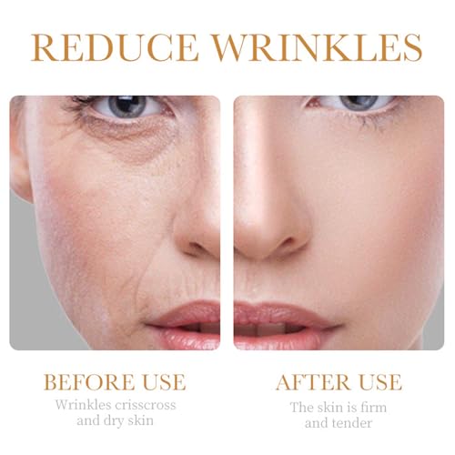Collagen Skin Care Set, 6Pcs Face Care Sets for Older Women, Firming Skin, Shrink Pores, Smooth Wrinkles, Hydrating Skin Care Set Include Serum Face Cream Eye Cream Toner Cleanser Facial Mask1