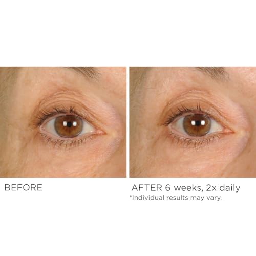 NassifMD Under Eye Anti-Aging Smoother Puffiness Dark Circles Eye Primer