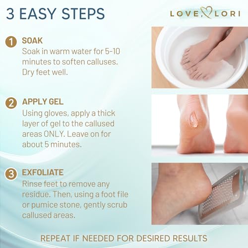 Love Lori Foot Callus Remover Gel Extra Strength Pedicure Tool for Feet 6oz