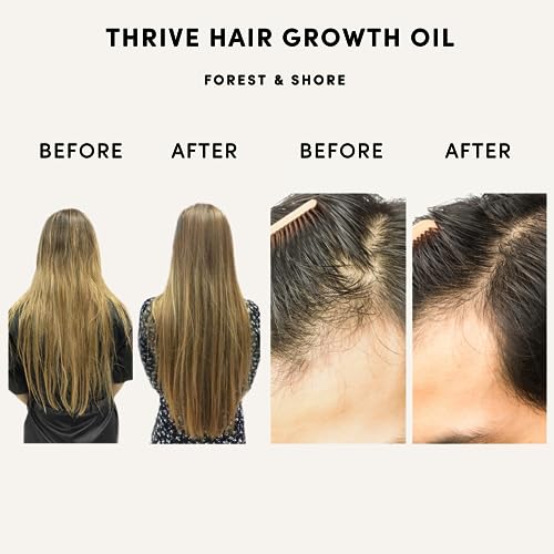 Forest & Shore Hair Growth Oil, 100% Natural, with Caffeine, Biotin, Castor , Argan & Rosemary, Effective Serum for Damaged Hair