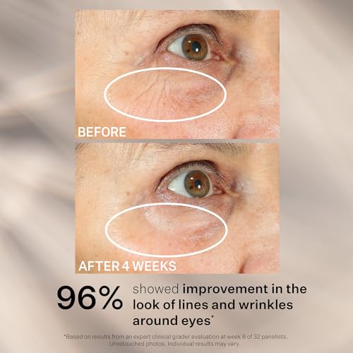 StriVectin Peptight® 360° Tightening & Brightening Eye Serum, 1 oz