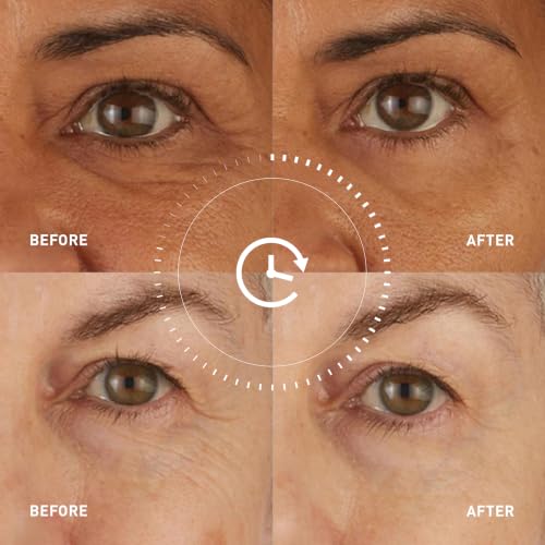 Skyn ICELAND Hydro Cool Firming Eye Patches with Peptides and Coenzyme Q10