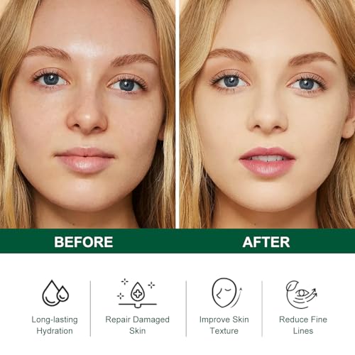 Tea Tree Salicylic Acid Facial Skin Care Set, Acne Treatment Skincare Set ,Skincare Mini Kit, Facial Kit Gifts for Women,Cleanser, Toner, Serum, Cream,Oil Control Facial Kit, Travel Size Set