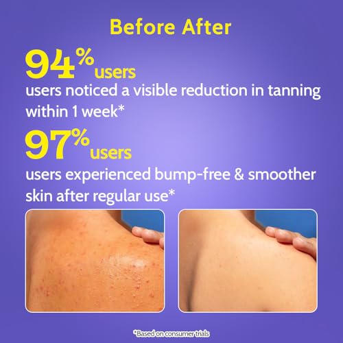 Chemist at Play Body Wash Exfoliating For Dry Rough Bumpy Strawberry Skin With 1% Salicylic Acid 2% Lactic Acid And Ceramides For Men And Women 7.9 Fl oz