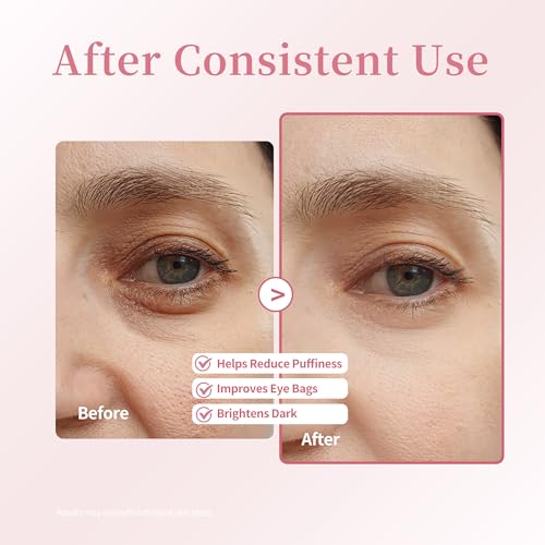 Retinol & Caffeine Under Eye Roller Serum | Xenjura Cooling Eye Cream for Puffy Eyes & Dark Circles | Anti Aging Wrinkle Remover for Fine Lines | Vegan Skincare (20ml / 0.7 fl oz)