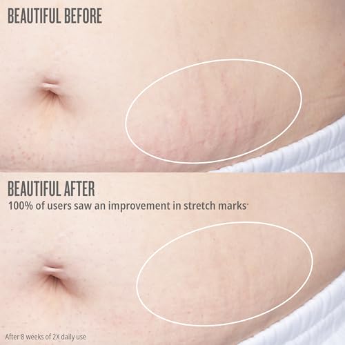 Sol de Janeiro Bum Bum Firmeza Body Oil - Stretch Mark Oil