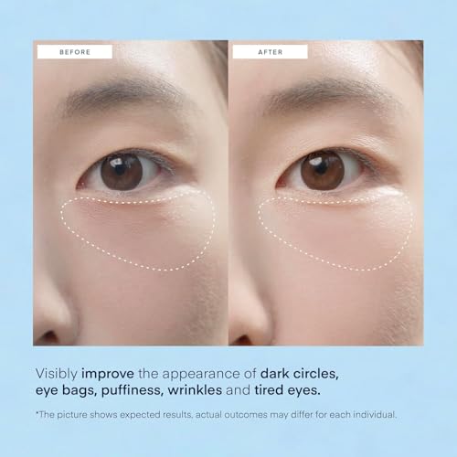 Terez & Honor Under Eye Patches for Dark Circles - 60 Korean Hydrogel Masks for Puffiness, Bags, Wrinkle with Caffeine, Hyaluronic Acid, Niacinamide - Undereye Hydrating & Cooling, Vegan, No Fragrance