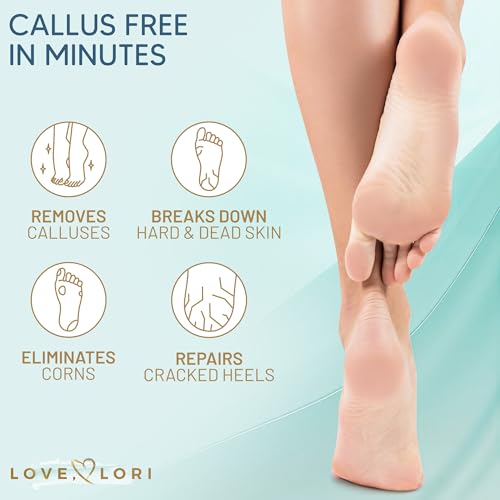 Love Lori Foot Callus Remover Gel Extra Strength Pedicure Tool for Feet 6oz