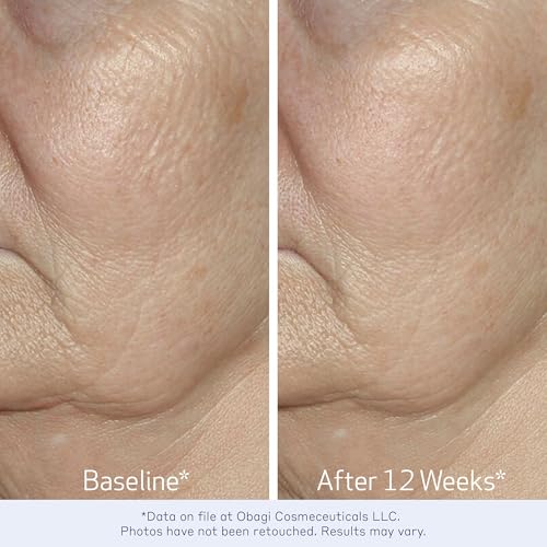 Obagi ELASTIderm Facial Serum – Firming Face Serum with Patented Bi-Mineral Contour Complex Clinically Proven to Target Signs Of Skin Aging – 1 oz