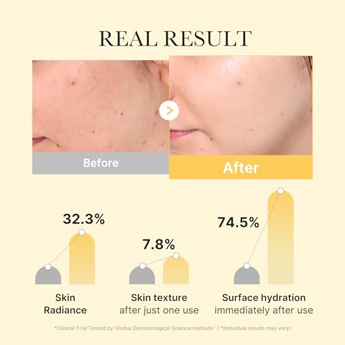 medicube Jelly Gel Mask with Brightening Kojic Acid Turmeric, 4EA
