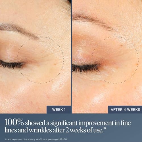 Summer Fridays Jet Lag Overnight Eye Serum - Nourishing Undereye Treatment for Dark Circles - Helps to Hydrate, Smooth, Firm & Depuff - Enriched with Glycerin to Lock in Moisture (0.5 Fl Oz)