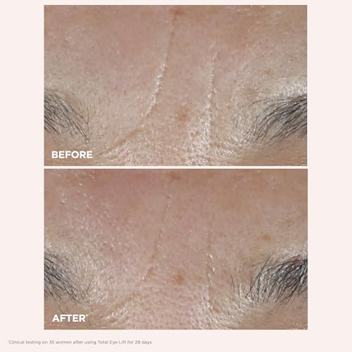 Clarins Total Eye Lift | Anti Aging Eye Cream | Targets Wrinkles, Crow's Feet, Dark Circles and Puffiness For a Visible Eye Lift in 30 Seconds