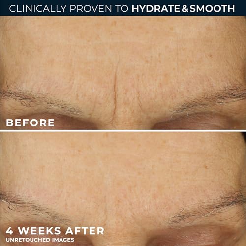 RoC Retinol Correxion Max Daily Hydration Face Moisturizer, Hyaluronic Acid