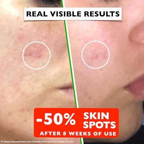 Vitamin C Serum For Face – Anti Aging Face Serum with Vitamin C, Hyaluronic Acid, Vitamin E. Brightening Formula. Improve Appearance of Dark Spots, Tone, Fine Lines & Wrinkles, Glowing Skin 2 Fl Oz