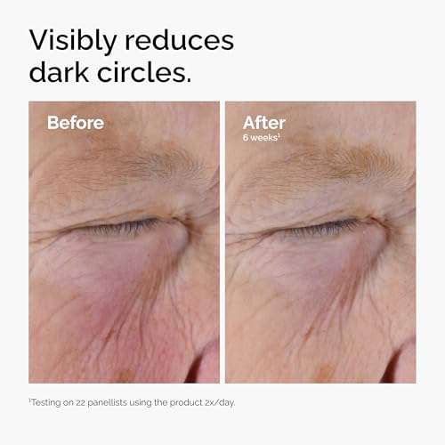The Ordinary Caffeine Solution 5% + EGCG Eye Serum, Depuffing Eye Serum for Dark Circles and Tired Eyes, 1 Fl Oz