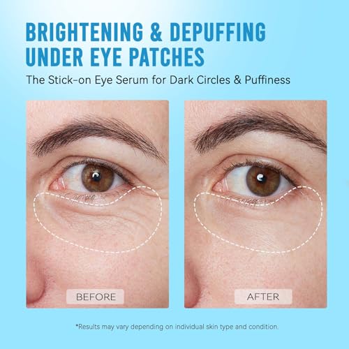 AILEORY Under Eye Patches for Dark Circles and Puffiness, Brightening Eye Masks with Caffeine, Niacinamide & Tranexamic Acid for Under-Eye Dullness, Depuffing Eye Treatment for Eye Bags, 24 Pairs