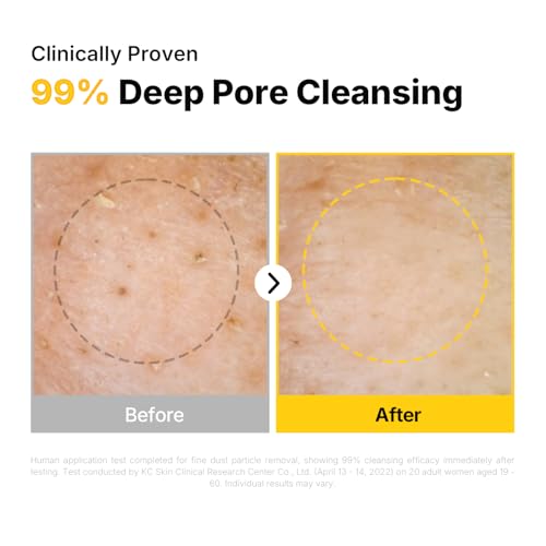 MANYO Pure Cleansing Oil, Natural Oil Cleanser for Face, Makeup Blackhead Remover, Korean Skin Care, 6.76 fl oz (200ml)