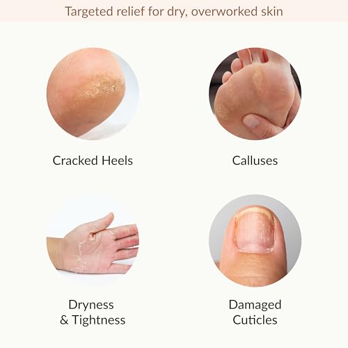 Epielle Hydrating & Moisturizing Hand & Foot Masks, Relieve and Soften Dry, Rough Skin, Self Care Gifts for Women, Spa Kit, 6 Moisturizing Gloves & 6 Moisturizing Socks