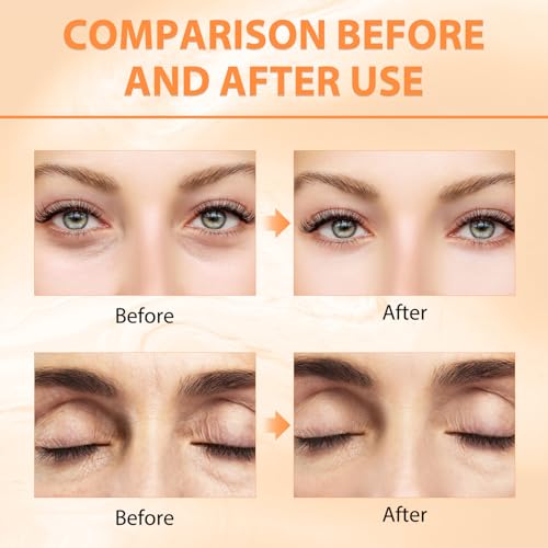 Tbexem Revive Glow Vitamin C Eye Balm, Hydrating Eye Cream,Improve Dark Circles,Brightens Skin Tone,Reduces Puffiness(2PCS)