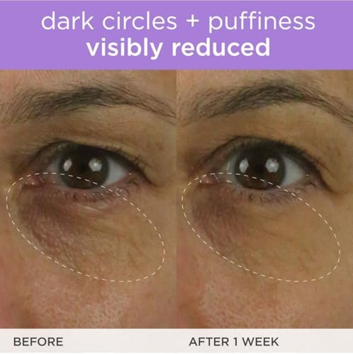 TATCHA The Brightening Eye Cream, Dark Circle Reduction with Vitamin C