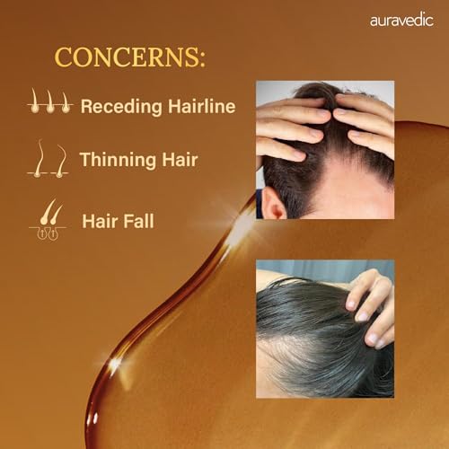 Auravedic Rosemary Oil for Hair Growth | Stronger, Fuller Hair | 3.38 Fl Oz