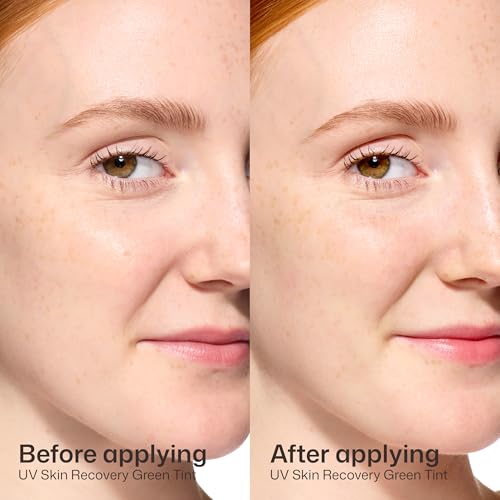 EltaMD UV Skin Recovery Green Tinted 100% Mineral Sunscreen, SPF 50, 1.7 oz