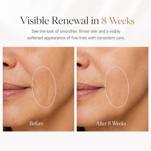 XIAOCHI 4-in-1 Facial Massager for Face & Neck, Red Light Skincare Device for Puffiness & Fine Line Care, At-Home Beauty Tool