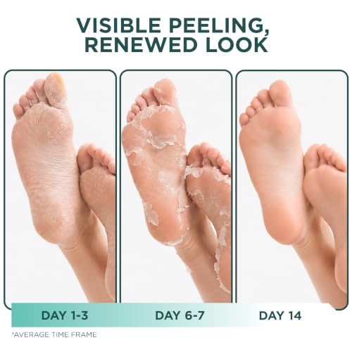 DERMORA Foot Peel Mask, Exfoliating Foot Peeling Mask, 2 Pairs, Original