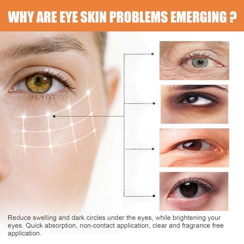 LOYOTICE 3Pcs Revive Glow Vitamin C Eye Balm, Hydrating Eye Cream, Glow Eye Balm Stick, Brightening and Reducing Dark Circle, Reduces Puffiness