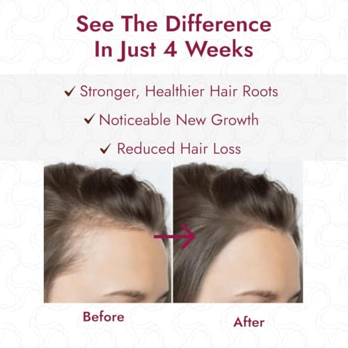 Redensyl Hair Serum Roll On – 3% Rosemary & 3% Redensyl Scalp Treatment for Thicker, Fuller Looking – Nourishing Hair Density Support for Women Pink (30 ml)