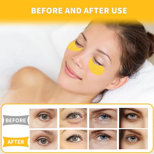 Qyiywim Under Eye Patches 70PCS, 24K Gold Eye Patches for Puffy Eyes Treatment, Under Eye Masks for Dark Circles and Puffiness, Non-Irritating Eye Mask Skincare, Eyes Bags Treatment, Eye Gel Pads