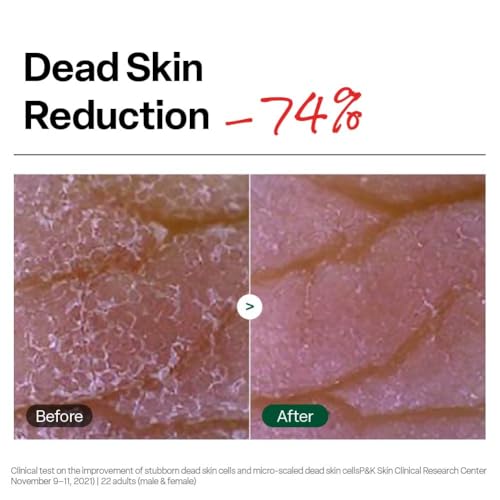 Dr.G Brightening Peeling Gel, Korean Skincare, 4.23 fl oz