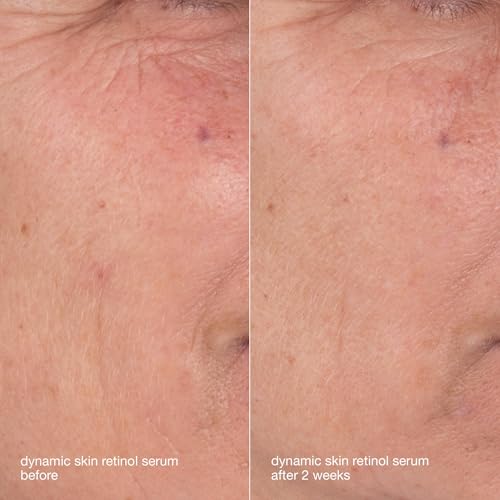 Dermalogica Skin Aging Solutions Kit, Anti Aging Skincare Set, Travel Size