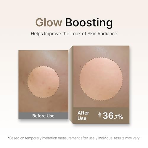 Starting Care Galactomyces Essence Toner, Hydration & Glow (5.24 fl oz)