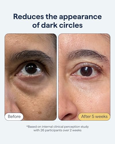 REMEDY Dark Circles Reducing Advanced Eye Cream with Caffeine, Niacinamide,