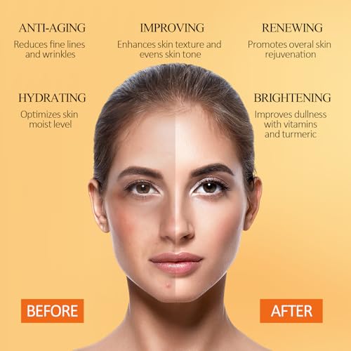 SHVYOG Turmeric Vitamin C Clay Mask with Kaolin Clay for Dull & Blemish-Prone Skin, Deep Cleansing Facial Mask, Face Masks Skincare for Controlling Oil and Refining Pores 5.29 Oz 150g