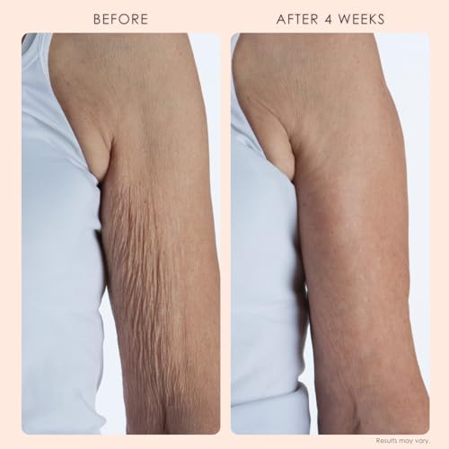 BODY FIRM Crepe Erase 2-Step Treatment, Exfoliant & Firming Cream, 10 FL Oz