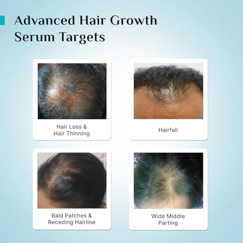 Pilgrim Advanced Hair Growth Serum with Redensyl 3%, Anagain 4% & Baicapil | Hair Fall Control & Regrowth | Korean Black Rice | For Men & Women, 1.01 Fl Oz (30ml)