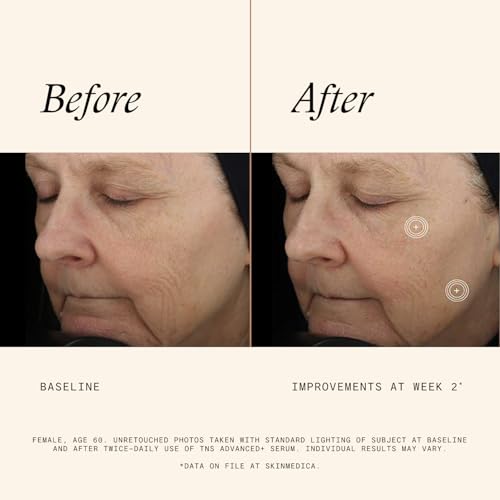 SkinMedica TNS Advanced+ Face Serum - Multi Peptide Serum to Help Improve the Appearance of Wrinkles, Fine Lines, Skin Tone & Texture (1 oz)