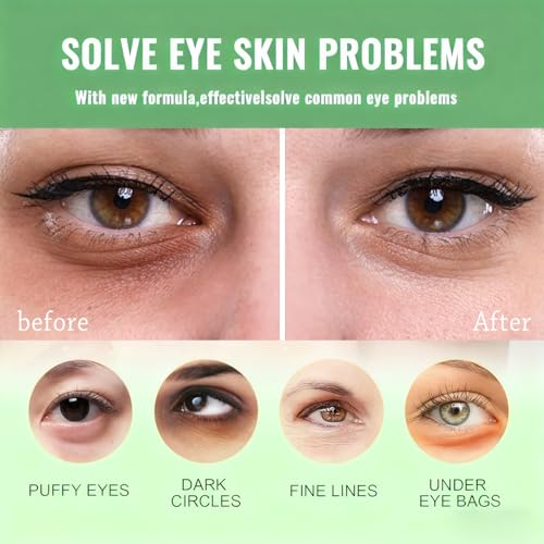 firstfly 60 Pcs Avocado Eye Mask, Under Eye Patches for Dark Circles and Puffiness, Moisturizing Nourishing Eye Treatment Mask, Improving Eye Skin Dryness, Fine Lines and Wrinkles