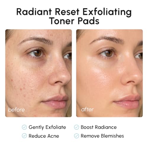 MAREE Glycolic Acid Pads - Toner Pads for Face Cleansing - Exfoliating Pad with Tea Tree Oil, Salicylic Acid & Vitamins E, B3, B5 - Facial Polishes & Peels, Skin Pore Resurfacing & Radiance - 50 Count