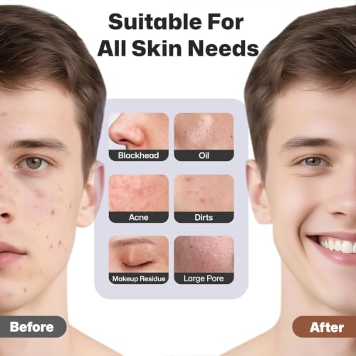 PRITECH Facial Cleansing Brush, Rechargeable Silicone Face Scrubber with Heat Massage End, Vibrating Exfoliator Scrubber for Deep Cleaning, Waterproof Face Brush for Women and Men (Black)
