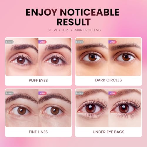 AILEORY Under Eye Patches (24 Pairs) - Tri-color Glitter Eye Gel Pads for Dark Circles, Puffy Eyes, Under eye Bags, Wrinkles | Natural Collagen Under Eye Mask Patches, Gel Under Eye Patches