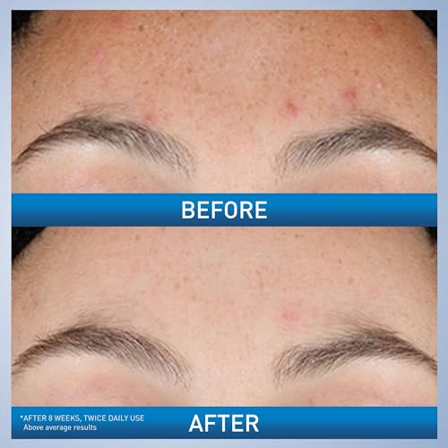 CeraVe Resurfacing Retinol Face Serum with Niacinamide, Pore Minimizer, 1oz