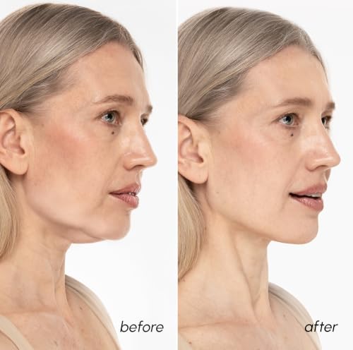 MAREE V Line Lifting Mask with 24K Gold – Deep Collagen Face Mask for Women – Jawline Shaper Mask with Retinol & Hyaluronic Acid – Neck Tightening & Firming - Double Chin Strap for Face Lift
