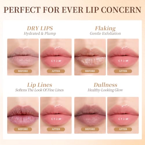 PDRN Lip Serum, Advanced PDRN Rejuvenating Hydrating Lip Balm, Hyaluronic Acid Lip Moisturizer Plumping for Dry Cracked Dark Lips, Gentle Exfoliation Smoothing Lip Treatment Overnight Cream, 0.33 OZ