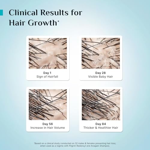 Pilgrim Advanced Hair Growth Serum with Redensyl 3%, Anagain 4% & Baicapil | Hair Fall Control & Regrowth | Korean Black Rice | For Men & Women, 1.01 Fl Oz (30ml)