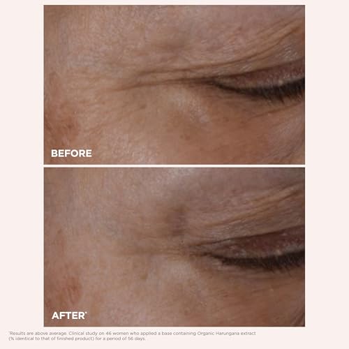 Clarins Total Eye Lift | Anti Aging Eye Cream | Targets Wrinkles, Crow's Feet, Dark Circles and Puffiness For a Visible Eye Lift in 30 Seconds