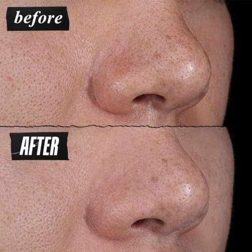 Kiehl's - Rare Earth Clay Face Mask - Minimizes Pores - Facial Mask