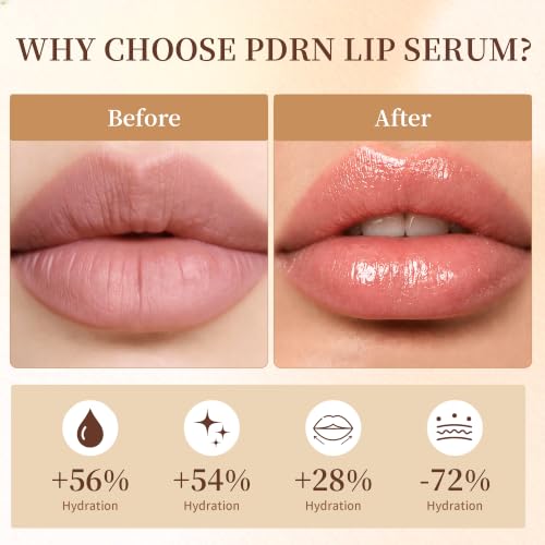 PDRN Lip Serum, Advanced PDRN Rejuvenating Hydrating Lip Balm, Hyaluronic Acid Lip Moisturizer Plumping for Dry Cracked Dark Lips, Gentle Exfoliation Smoothing Lip Treatment Overnight Cream, 0.33 OZ